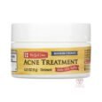 🧴 De La Cruz Acne Treatment Ointment 10% Sulfur Maximum Strength 6ml