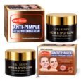 EBJ Anti-Pimple Facial Whitening Cream 50g